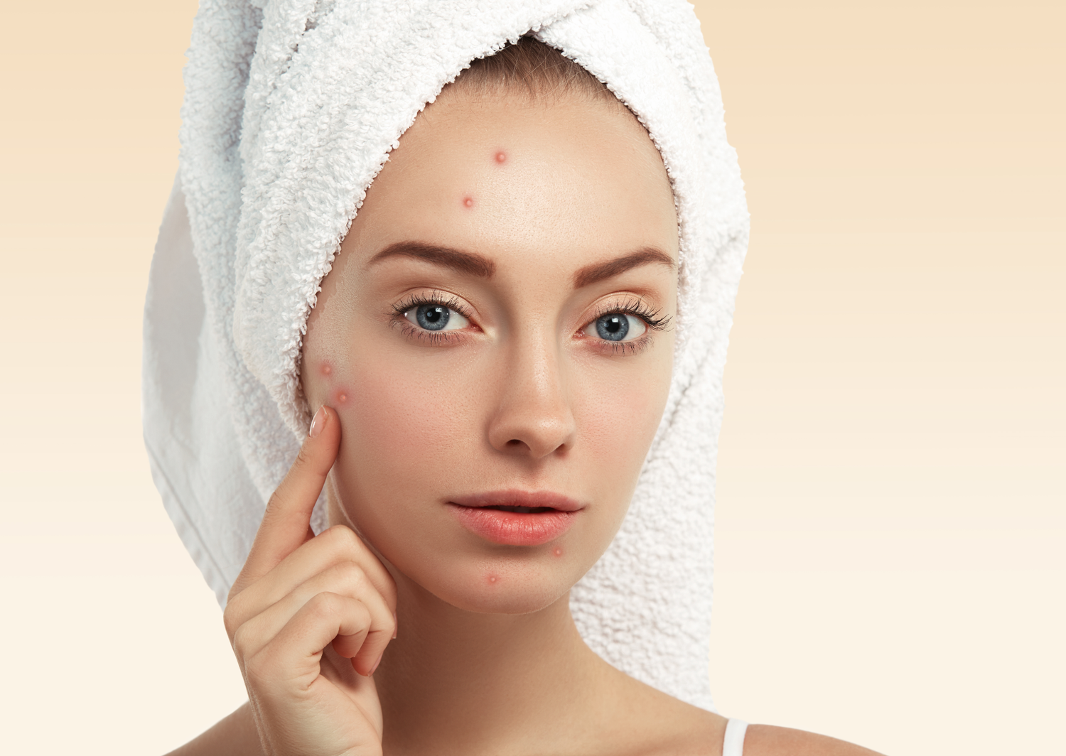 The Ultimate Guide to Effective Skincare for Acne