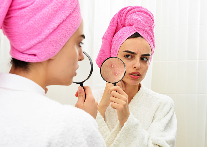 Can Face Wash Help with Pimples and Acne
