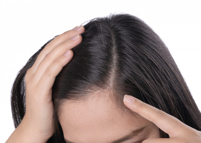 How Summer Heat and Sweat Damage Your Scalp – And How to Fix It